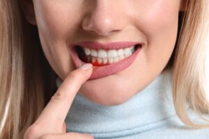 Signs and Symptoms of Common Dental Issues