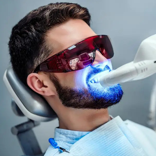 Laser-Dental-Cleaning