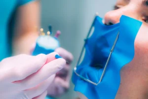 Root-Canal-Procedure