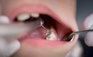 b2ap3_amp_Woodlands-Dentist-1024x630