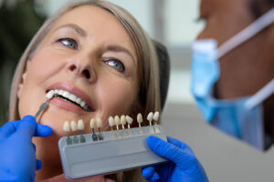 veneers smile