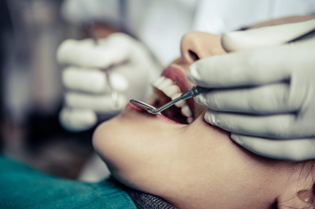 Simple vs. Surgical Tooth Extractions