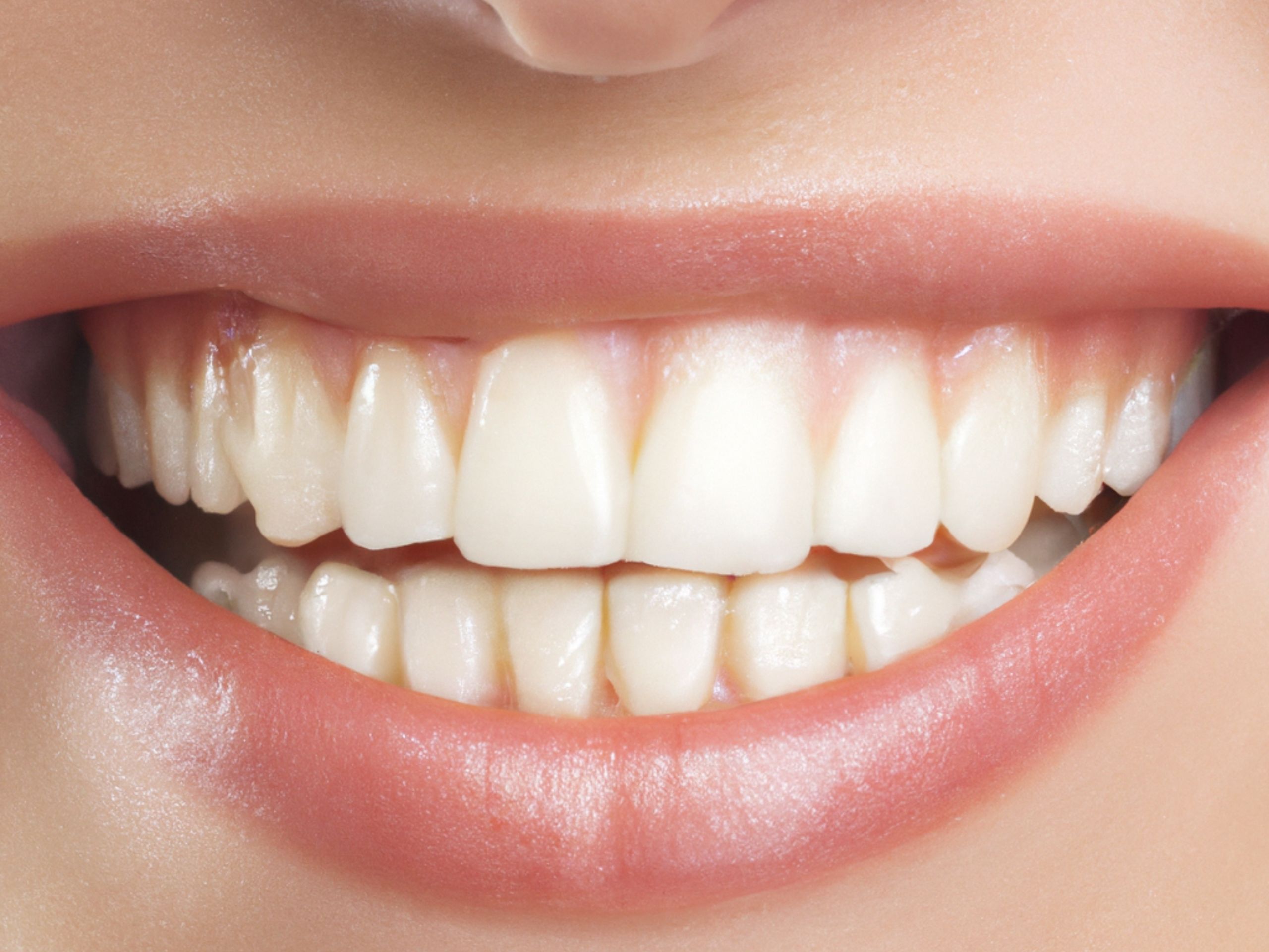 tooth implant cost